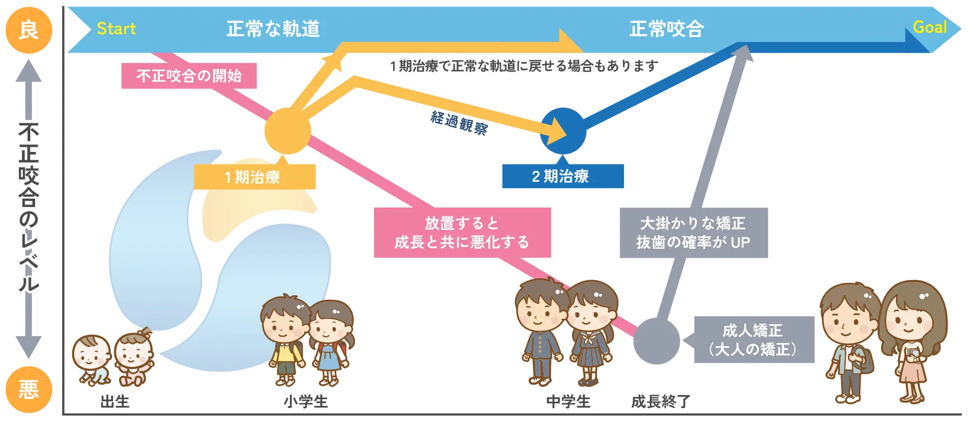 小児矯正歯科の治療の流れ