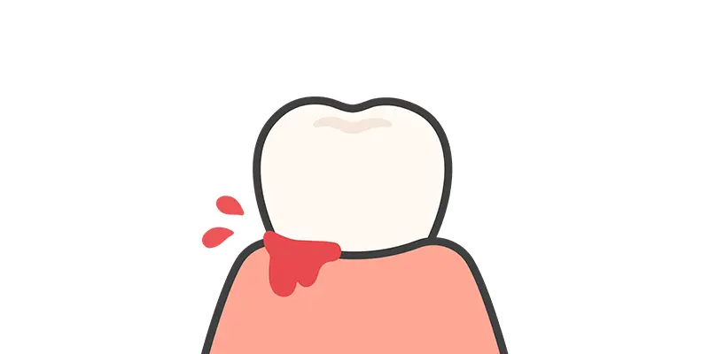 虫歯、歯周病の予防にも繋がる