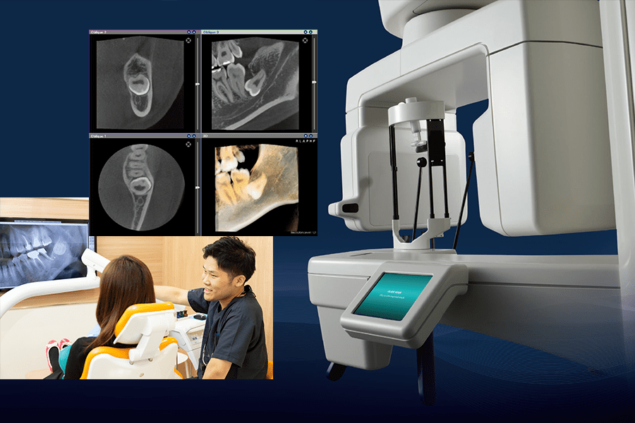 歯科用CTによる精密な検査