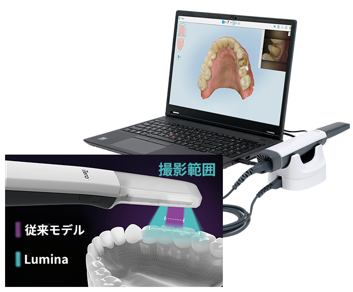 iTero Lumina（アイテロ ルミナ）